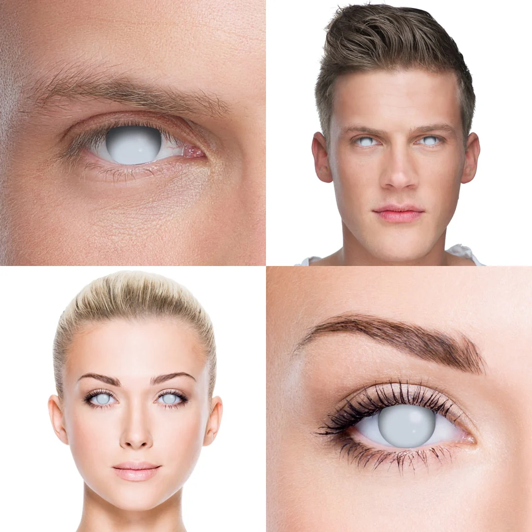 Blind White - Image 9